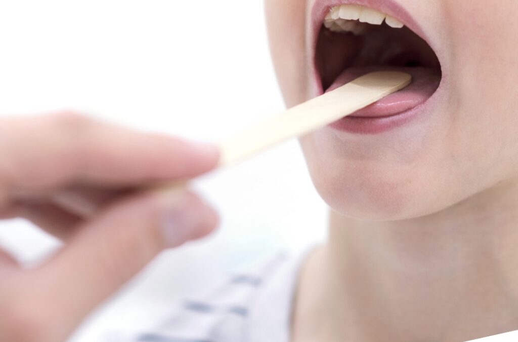 Angina Paciorkowcowa